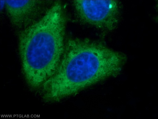 [60073-2-IG-150UL] RRM1 Monoclonal antibody