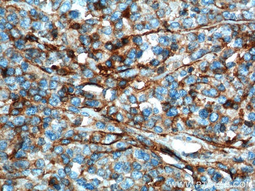 [60074-1-IG-20UL] IFITM1-Specific Monoclonal antibody