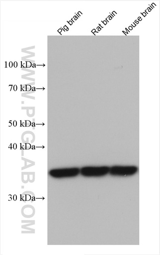 [60076-1-IG-150UL] SULT1A1 Monoclonal antibody