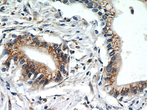 [60085-2-IG-20UL] EEF1D Monoclonal antibody