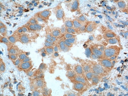 [60094-2-IG-150UL] PFN2 Monoclonal antibody