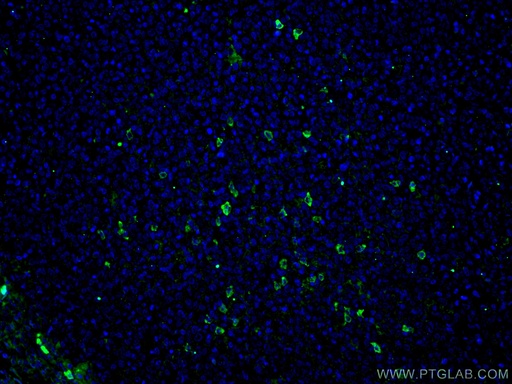 [60099-1-IG-20UL] Human IgA Monoclonal antibody