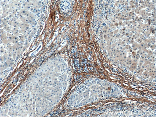 [60108-1-IG-20UL] Fibromodulin Monoclonal antibody
