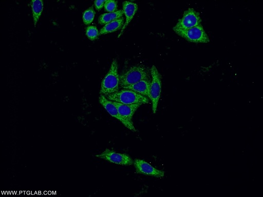 [60113-1-IG-150UL] SERPINA10 Monoclonal antibody