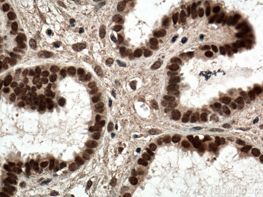 [60117-2-IG-150UL] NR2F6 Monoclonal antibody