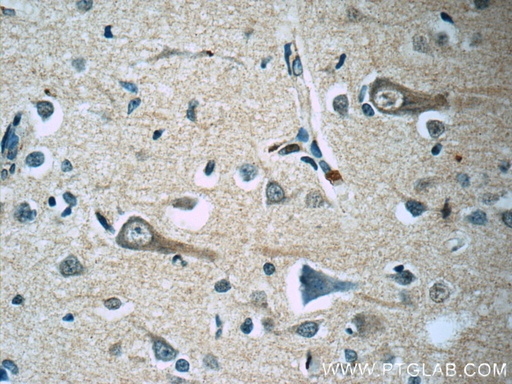 [60122-1-IG-150UL] KCNMB4 Monoclonal antibody
