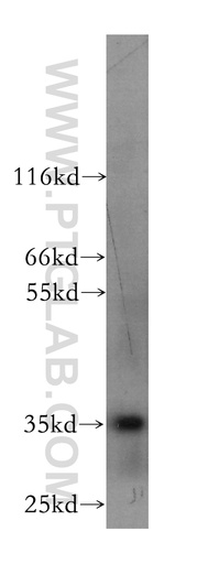 [60123-1-IG-150UL] CXCL16 Monoclonal antibody