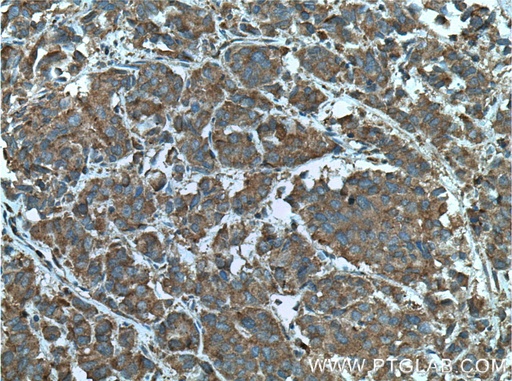 [60125-1-IG-20UL] RABEP2 Monoclonal antibody
