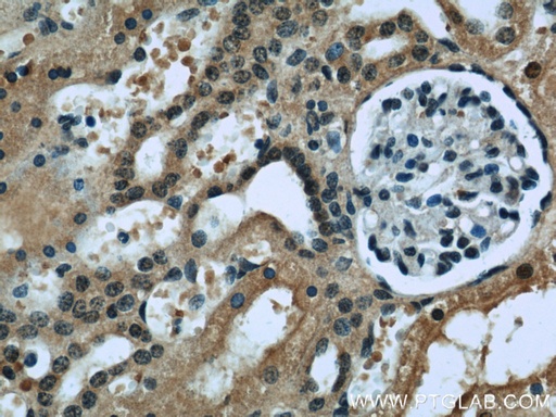 [60128-1-IG-150UL] RENALASE Monoclonal antibody