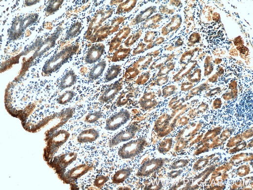[60130-1-IG-150UL] Gastrokine 1 Monoclonal antibody