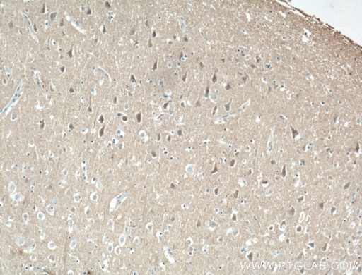 [60133-1-IG-20UL] KCNIP4 Monoclonal antibody