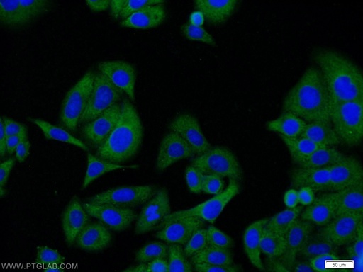 [60134-1-IG-20UL] NR1H3 Monoclonal antibody