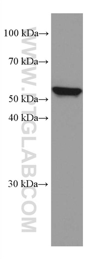 [60138-1-IG-150UL] IL-15RA Monoclonal antibody