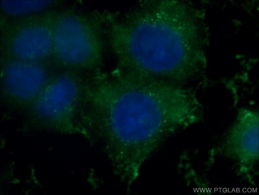 [60150-2-IG-150UL] GSTO1 Monoclonal antibody