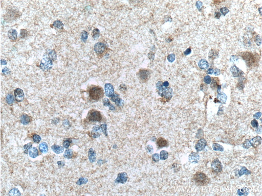 [60151-1-IG-150UL] CUL4B Monoclonal antibody