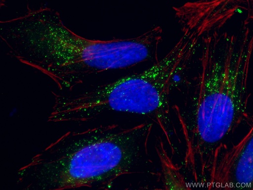 [60153-1-IG-150UL] ABCD1 Monoclonal antibody