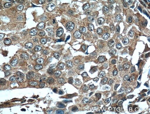 [60155-2-IG-20UL] EPHA1-specific Monoclonal antibody