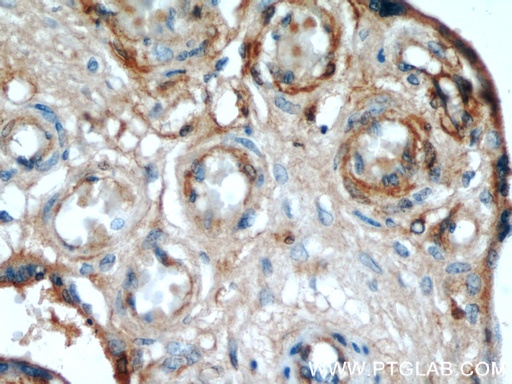 [60156-1-IG-20UL] AMOT Monoclonal antibody
