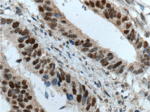 [60161-1-IG-20UL] MSH2 Monoclonal antibody