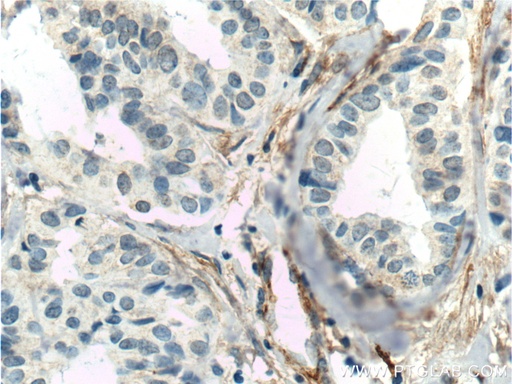 [60170-1-IG-20UL] TEM1 Monoclonal antibody