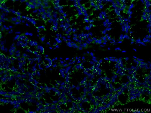[60171-1-IG-20UL] ALDH1A1 Monoclonal antibody