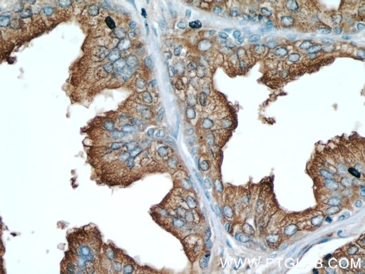 [60176-1-IG-150UL] ACPP Monoclonal antibody