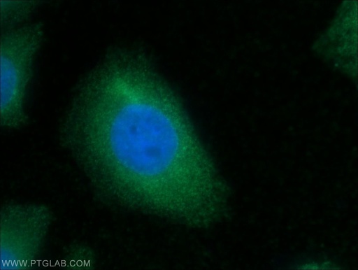 [60177-1-IG-20UL] CKM-Specific Monoclonal antibody