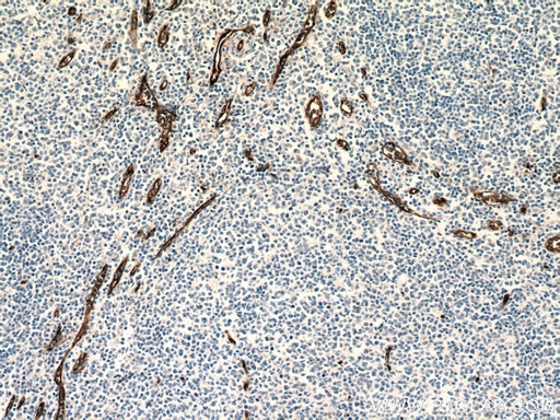 [60180-2-IG-150UL] CD34 Monoclonal antibody