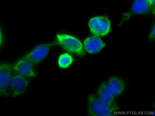 [60183-1-IG-20UL] Cytokeratin 20 Monoclonal antibody