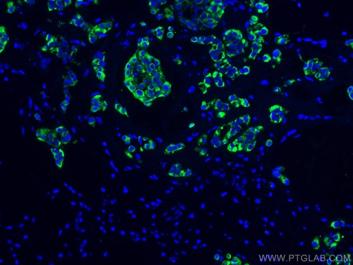 [60187-1-IG-20UL] Cytokeratin 19 Monoclonal antibody