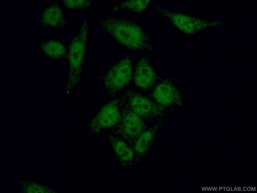 [60188-1-IG-20UL] WTAP Monoclonal antibody
