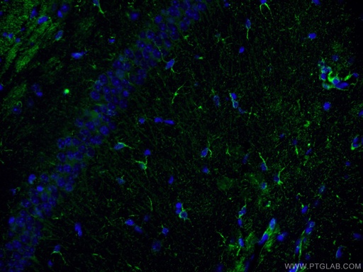 [60189-1-IG-150UL] NF-L Monoclonal antibody