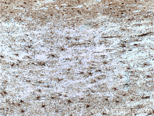 [60190-1-IG-150UL] GFAP Monoclonal antibody