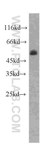 [60193-1-IG-20UL] PPARD Monoclonal antibody