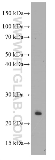 [60194-1-IG-150UL] CD3 Delta Monoclonal antibody