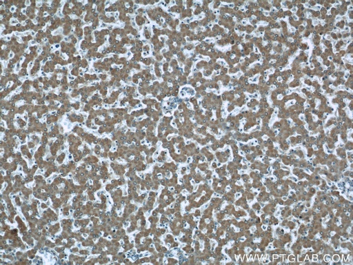 [60195-1-IG-150UL] TMEM70 Monoclonal antibody