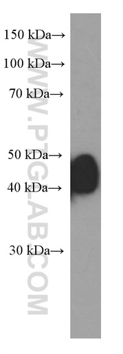 [60197-1-IG-20UL] ESR2 Monoclonal antibody