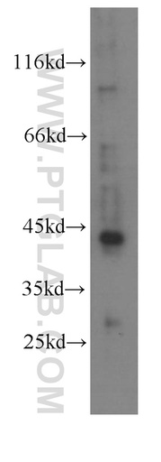 [60198-1-IG-150UL] RXRA Monoclonal antibody