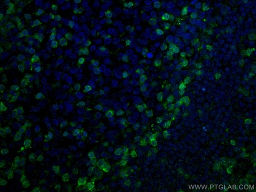[60200-1-IG-150UL] ZAP70 Monoclonal antibody