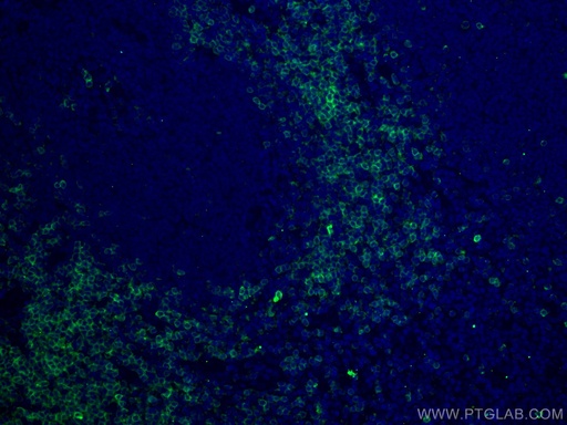 [60209-1-IG-20UL] CD7 Monoclonal antibody