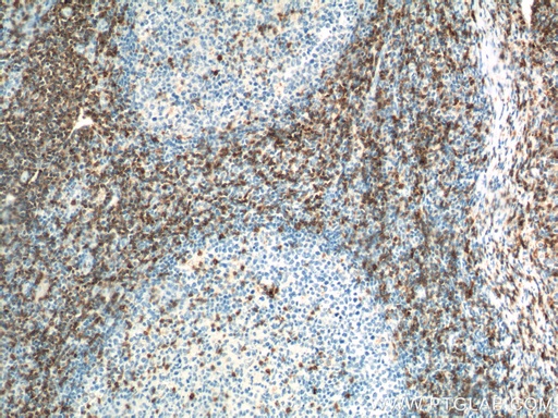 [60209-2-IG-20UL] CD7 Monoclonal antibody