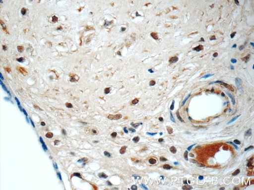 [60211-1-IG-150UL] LYN Monoclonal antibody