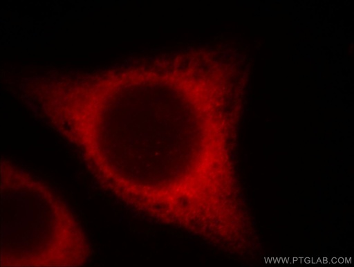 [60212-1-IG-150UL] BCS1L Monoclonal antibody
