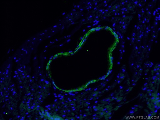 [60213-1-IG-150UL] transgelin/SM22 Monoclonal antibody