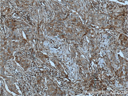 [60216-1-IG-20UL] CXCR7 Monoclonal antibody