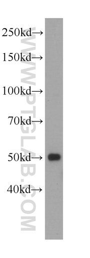 [60217-1-IG-20UL] PAX1-Specific Monoclonal antibody