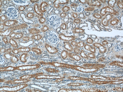 [60227-1-IG-20UL] IFT88 Monoclonal antibody