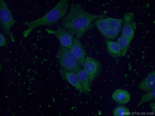 [60228-1-IG-150UL] Cytoglobin Monoclonal antibody