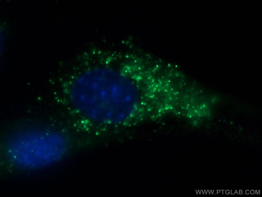 [60229-1-IG-150UL] Myosin Light Chain 2/MLC-2V Monoclonal antibody