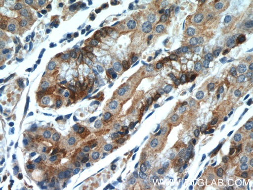 [60230-1-IG-20UL] FUT9 Monoclonal antibody
